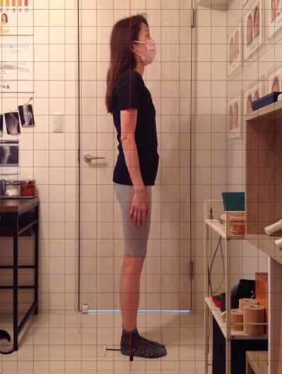 背骨×骨盤整復矯による施術効果