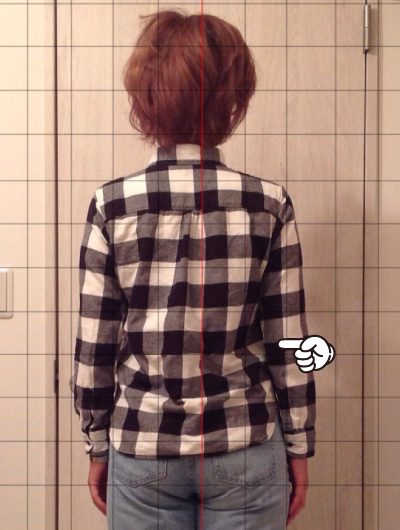 美骨整復術による改善例