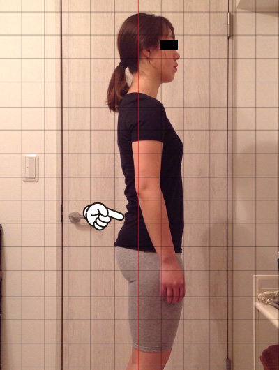 美骨整復術による改善例