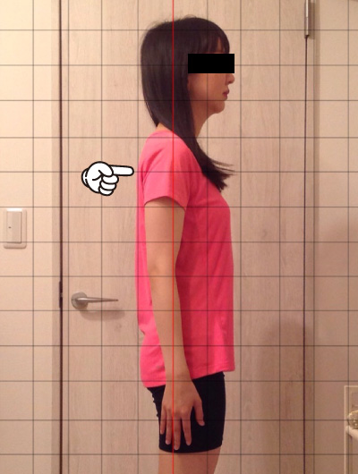 美骨整復術による改善例