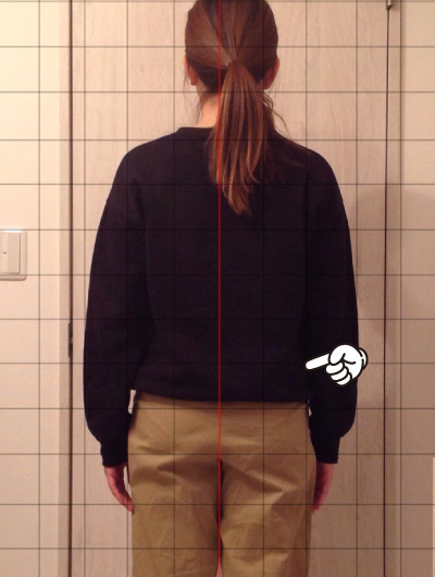 美骨整復術による改善例