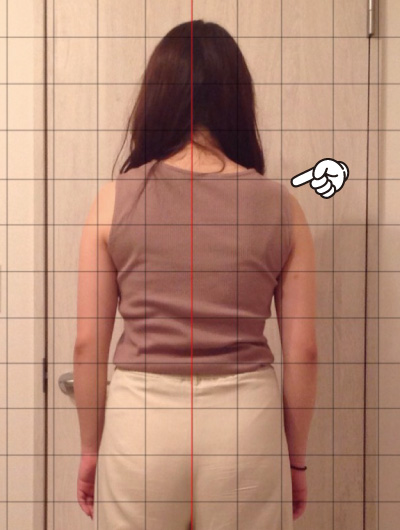 美骨整復術による改善例