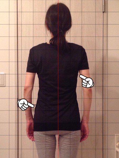 美骨整復術による改善例