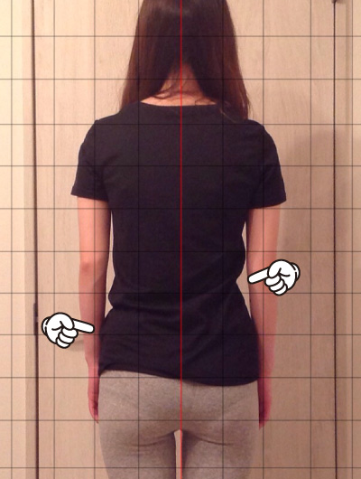 美骨整復術による改善例