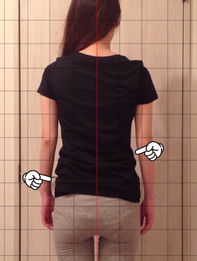 美骨整復術による改善例