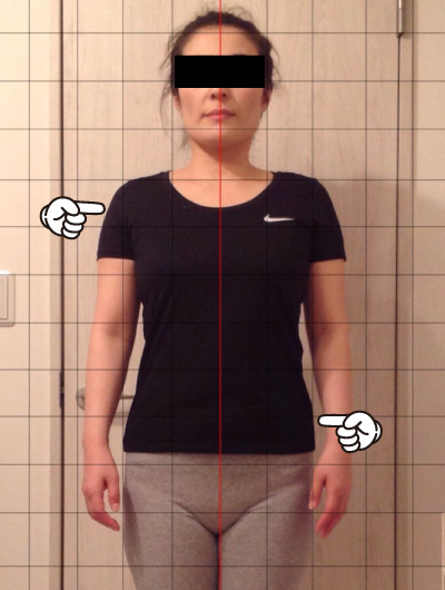 美骨整復術による改善例