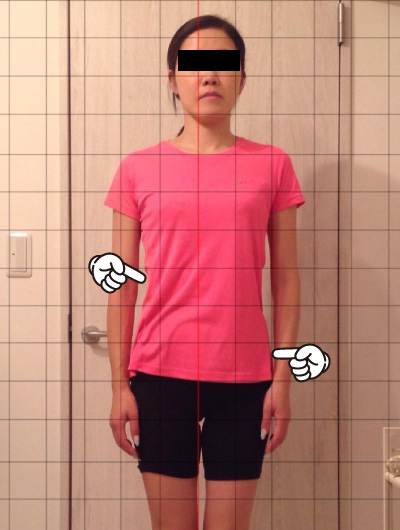 美骨整復術による改善例