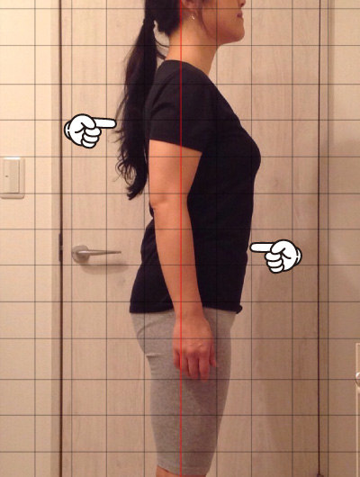 美骨整復術による改善例