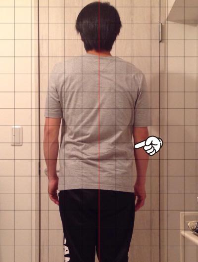 美骨整復術による改善例