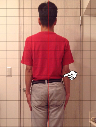 美骨整復術による改善例