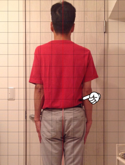 美骨整復術による改善例