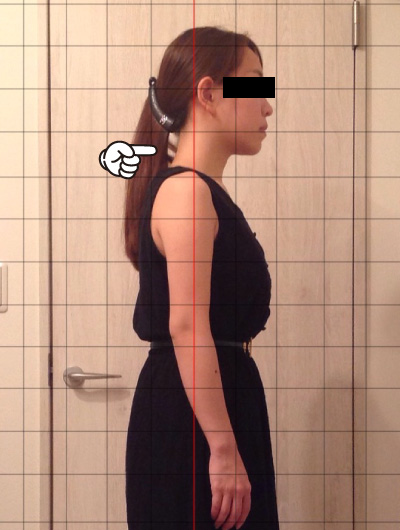 美骨整復術による改善例