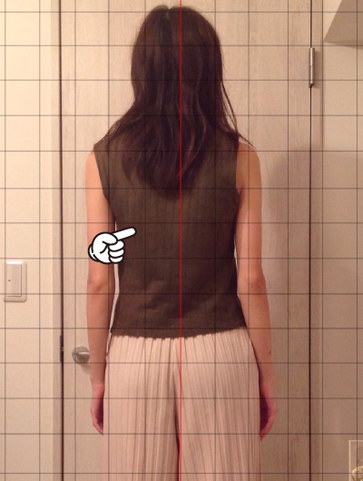 美骨整復術による改善例