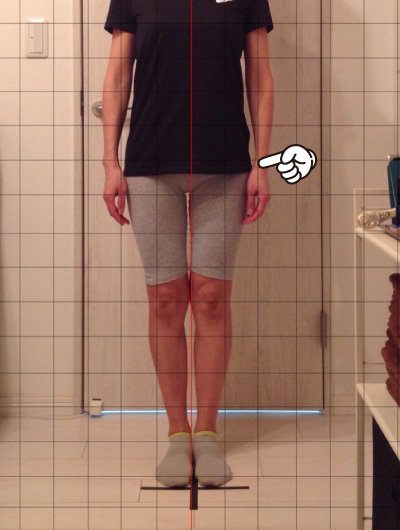 美骨整復術による改善例